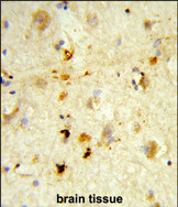 Anti-ITGBL1 antibody, Internal used in IHC (Formalin-fixed paraffin-embedded sections). GTX81030