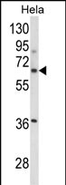 Anti-ITGBL1 antibody, Internal used in Western blot. GTX81030