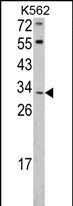 Anti-ITM2A antibody, N-term used in Western blot. GTX81726