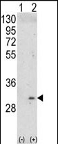 Anti-ITM2A antibody, N-term used in Western blot. GTX81726