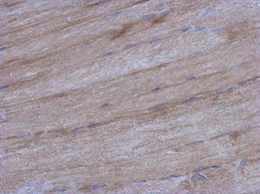 Anti-IVNS1ABP antibody used in IHC (Formalin-fixed paraffin-embedded sections). GTX118817