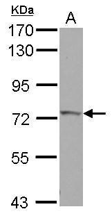 Anti-IVNS1ABP antibody used in Western blot. GTX118817