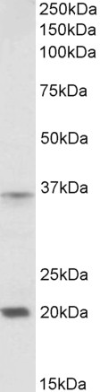 Anti-HOXA9 antibody, Internal used in Western blot. GTX88092