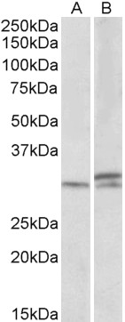 Anti-HOXA9 antibody, Internal used in Western blot. GTX88093
