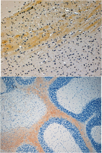 Anti-JIP3 / Syd2 / JSAP1 antibody, N-term used in IHC (Formalin-fixed paraffin-embedded sections). GTX24545