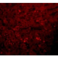 Anti-JMJD1A antibody used in ICC/IF. GTX85253