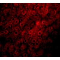 Anti-JMJD1C antibody used in ICC/IF. GTX85014