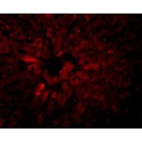 Anti-JMJD5 antibody used in ICC/IF. GTX85251