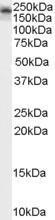 Anti-Kalirin (isoform 2) antibody, C-term used in Western blot. GTX89287