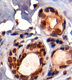 Anti-KAP1 antibody, C-term used in IHC (Formalin-fixed paraffin-embedded sections). GTX89879