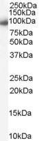 Anti-Karyopherin (importin) beta 1 antibody, C-term used in Western blot. GTX89314