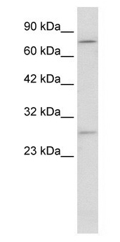 Anti-KCNH5 antibody, Internal used in Western blot. GTX47624