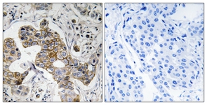 Anti-KCNK15 antibody used in IHC (Formalin-fixed paraffin-embedded sections). GTX87879