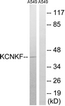 Anti-KCNK15 antibody used in Western blot. GTX87879