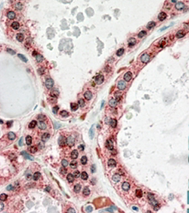 Anti-KCNN2 antibody, Internal used in IHC (Formalin-fixed paraffin-embedded sections). GTX88269