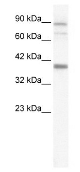 Anti-KCNN3 antibody, C-term used in Western blot. GTX47634