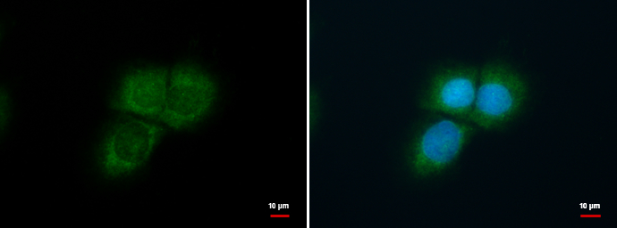 Anti-KF1 antibody used in ICC/IF. GTX116221