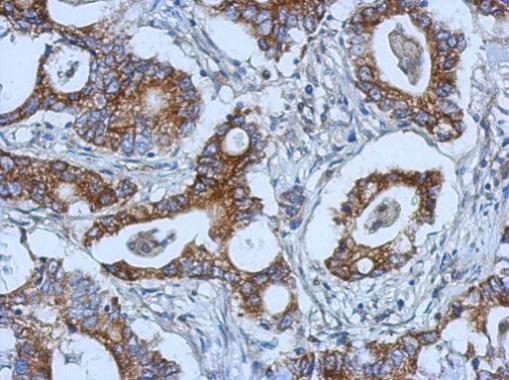 Anti-KIAA0196 antibody [C2C3], C-term used in IHC (Formalin-fixed paraffin-embedded sections). GTX115311