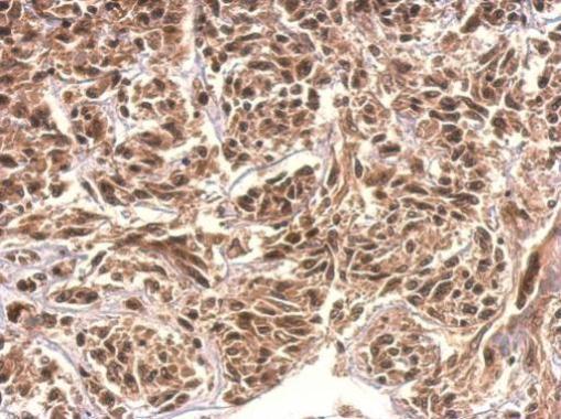 Anti-KIAA0323 antibody [C2C3], C-term used in IHC (Formalin-fixed paraffin-embedded sections). GTX120182
