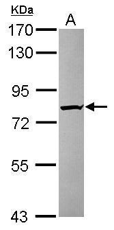Anti-KIAA0323 antibody [C2C3], C-term used in Western blot. GTX120182
