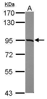Anti-KIAA0323 antibody [C2C3], C-term used in Western blot. GTX120182