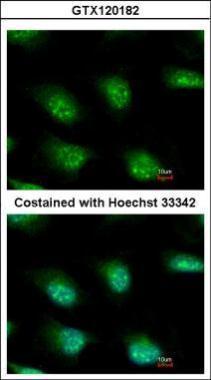 Anti-KIAA0323 antibody [C2C3], C-term used in ICC/IF. GTX120182