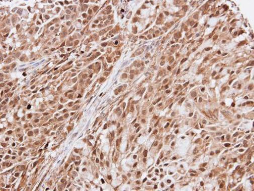 Anti-KIAA0494 antibody [N3C3] used in IHC (Formalin-fixed paraffin-embedded sections). GTX102173