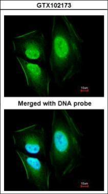 Anti-KIAA0494 antibody [N3C3] used in ICC/IF. GTX102173
