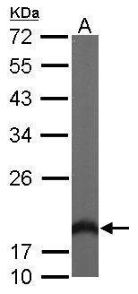 Anti-HPCAL1 antibody [N1C3] used in Western blot. GTX101816