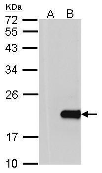 Anti-HPCAL1 antibody [N1C3] used in Western blot. GTX101816