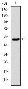Anti-KID antibody [1E3] used in Western blot. GTX60508