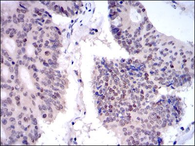 Anti-KID antibody [1E3] used in IHC (Formalin-fixed paraffin-embedded sections). GTX60508