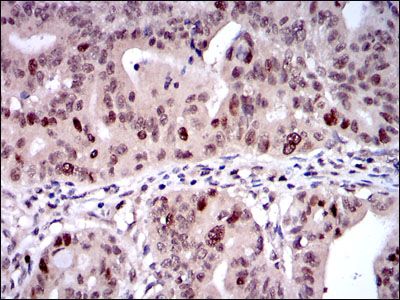 Anti-KID antibody [1E3] used in IHC (Formalin-fixed paraffin-embedded sections). GTX60508
