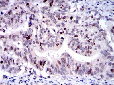 Anti-KID antibody [5F3] used in IHC (Formalin-fixed paraffin-embedded sections). GTX60506
