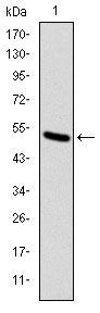 Anti-KID antibody [5F3] used in Western blot. GTX60506