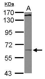 Anti-KIF19 antibody [N1N3] used in Western blot. GTX118841