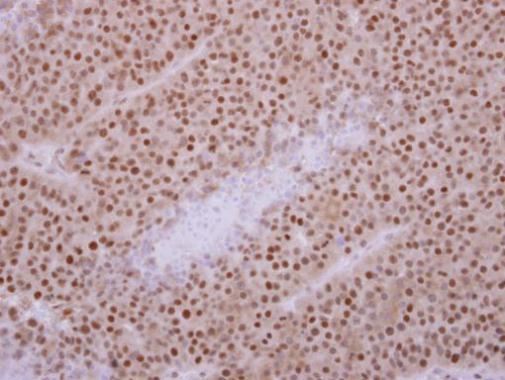 Anti-KIF3C antibody used in IHC (Formalin-fixed paraffin-embedded sections). GTX112629