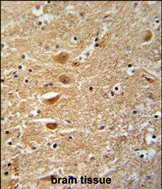 Anti-KIF3C antibody, C-term used in IHC (Formalin-fixed paraffin-embedded sections). GTX81431