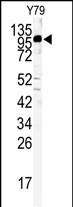 Anti-KIF3C antibody, C-term used in Western blot. GTX81431