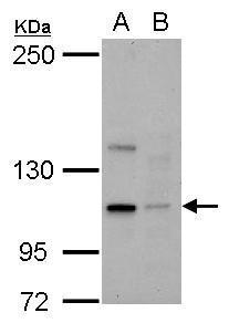 Anti-KIFC2 antibody [N3C2], Internal used in Western blot. GTX124082