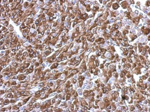 Anti-KIFC2 antibody [N3C2], Internal used in IHC (Formalin-fixed paraffin-embedded sections). GTX124082