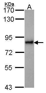 Anti-KIFC3 antibody used in Western blot. GTX114507