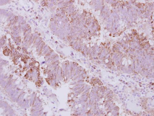 Anti-KIFC3 antibody used in IHC (Formalin-fixed paraffin-embedded sections). GTX114507
