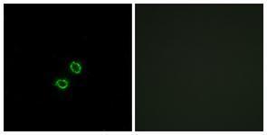 Anti-KIR2DL5B antibody used in ICC/IF. GTX87112