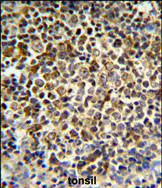 Anti-KIR2DL5B antibody, Internal used in IHC (Formalin-fixed paraffin-embedded sections). GTX80947