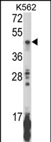 Anti-KIR2DL5B antibody, Internal used in Western blot. GTX80947