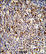 Anti-KIR3DL3 antibody, Internal used in IHC (Formalin-fixed paraffin-embedded sections). GTX80516