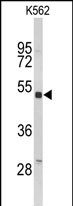 Anti-KIR3DL3 antibody, Internal used in Western blot. GTX80516