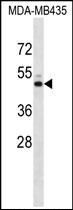 Anti-Kir7.1 antibody used in Western blot. GTX53659