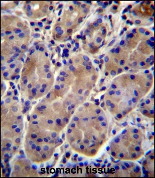Anti-Kir7.1 antibody used in IHC (Formalin-fixed paraffin-embedded sections). GTX53659